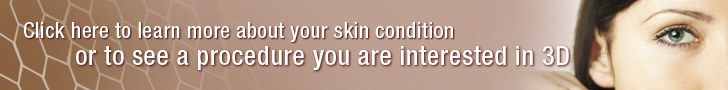 Click here to learn more about your skin condition or to see a procedure you are interested in 3D